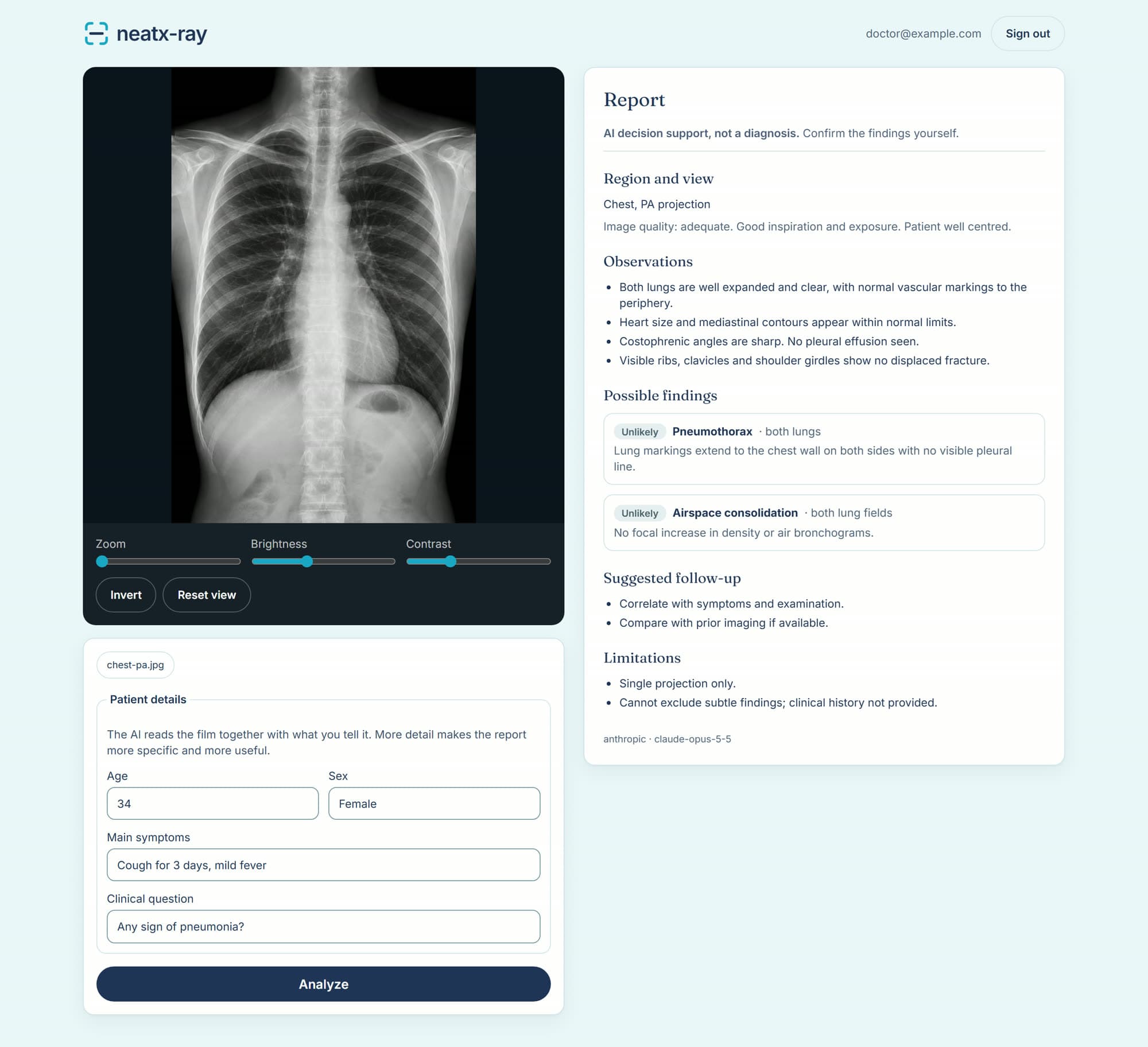 The neatx-ray app showing a chest X-ray in the viewer and a structured AI report beside it